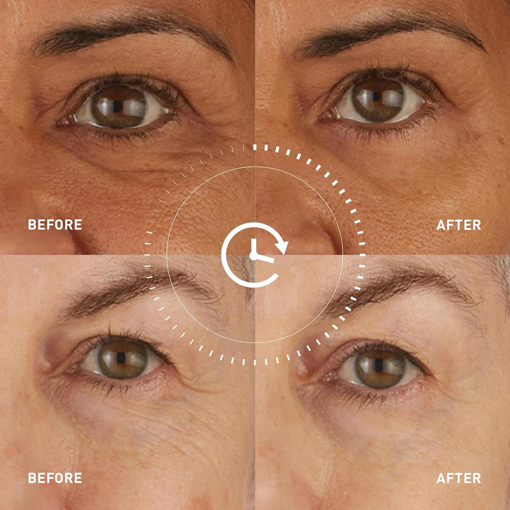 skyn ICELAND Hydro Cool Firming Eye Patches with Peptides and Coenzyme Q10